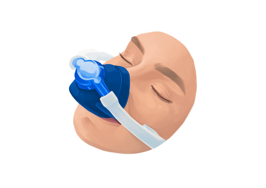 woman using nitrous oxide, a type of sedation dentistry or dental sedation for dental anxiety