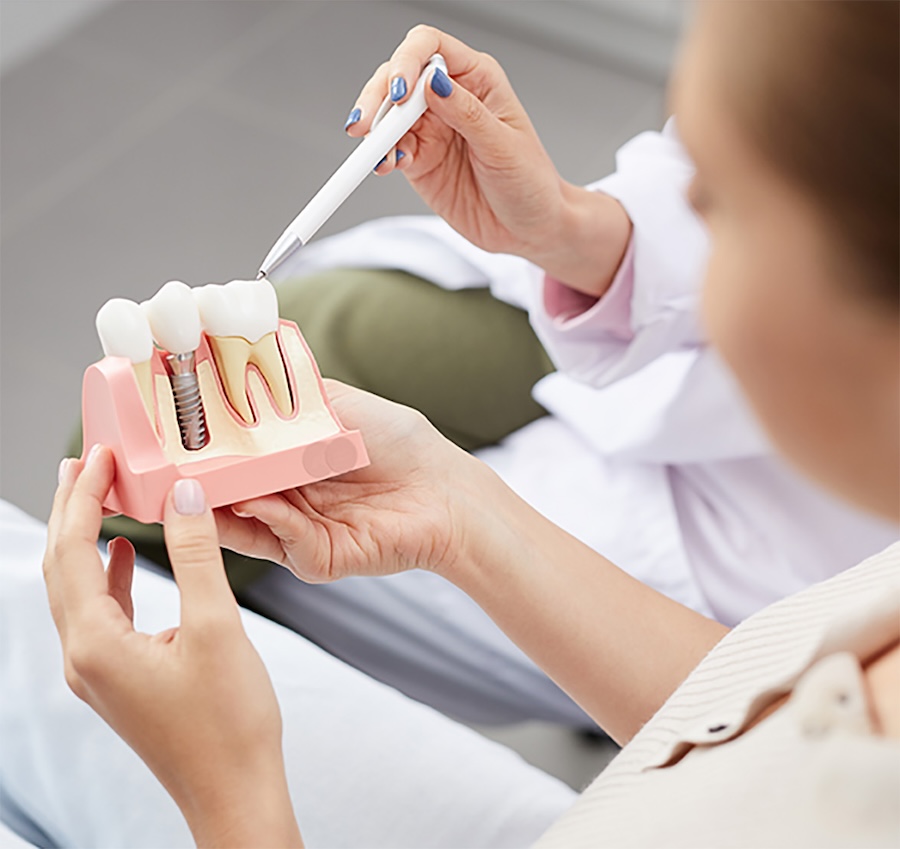 consultation at dentist office about dental implants